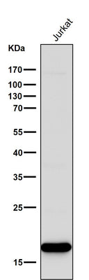 Anti-CD3 zeta CD247 Rabbit Monoclonal Antibody Boster Bio