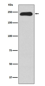 Anti-MYH11 Rabbit Monoclonal Antibody Boster Bio