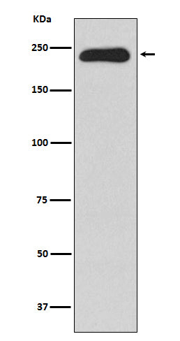 Anti-MYH11 Rabbit Monoclonal Antibody Boster Bio