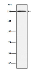 Anti-MYH11 Rabbit Monoclonal Antibody Boster Bio