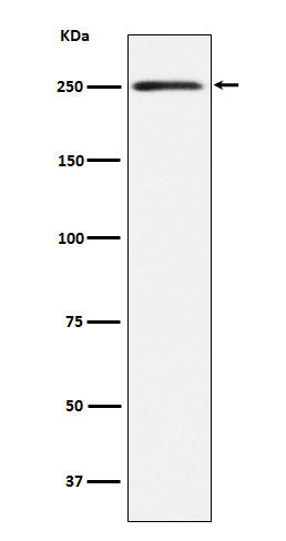 Anti-MYH11 Rabbit Monoclonal Antibody Boster Bio