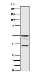 Anti-Bag1 Rabbit Monoclonal Antibody Boster Bio