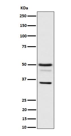 Anti-Bag1 Rabbit Monoclonal Antibody Boster Bio