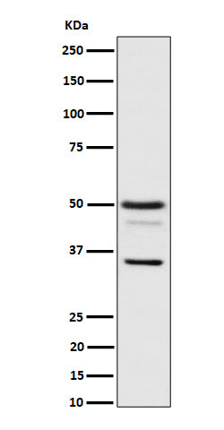 Anti-Bag1 Rabbit Monoclonal Antibody Boster Bio