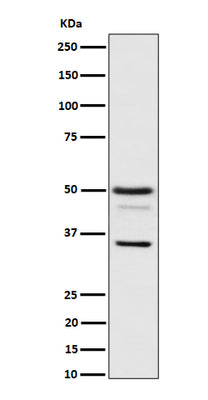 Anti-Bag1 Rabbit Monoclonal Antibody Boster Bio