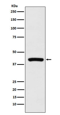 Anti-Cyclophilin 40 Rabbit Monoclonal Antibody Boster Bio