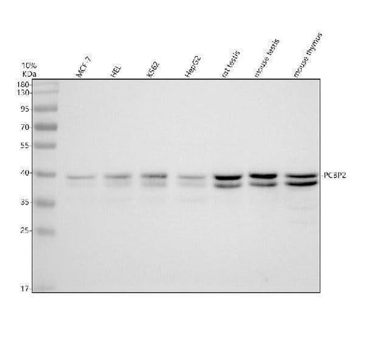 Anti-PCBP2 Rabbit Monoclonal Antibody Boster Bio