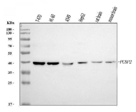 Anti-PCBP2/hnRNP E2 Antibody Picoband® (monoclonal, 4B9C7 Boster Bio