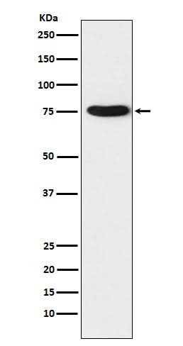 Anti-TRAP1 Rabbit Monoclonal Antibody Boster Bio