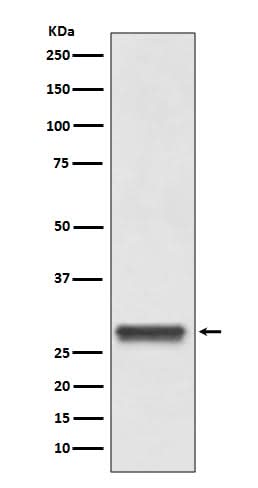 Anti-14-3-3 YWHAB Rabbit Monoclonal Antibody Boster Bio