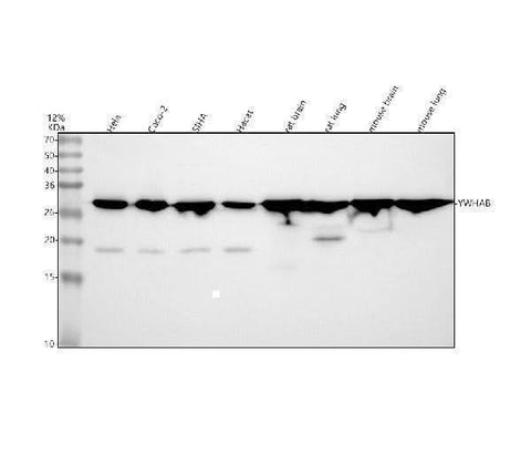 Anti-14-3-3 alpha + beta YWHAB Rabbit Monoclonal Antibody Boster Bio