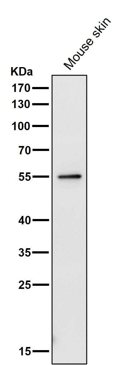 Anti-PRP19 PRPF19 Rabbit Monoclonal Antibody Boster Bio