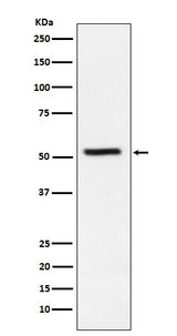 Anti-TrpRS Rabbit Monoclonal Antibody Boster Bio