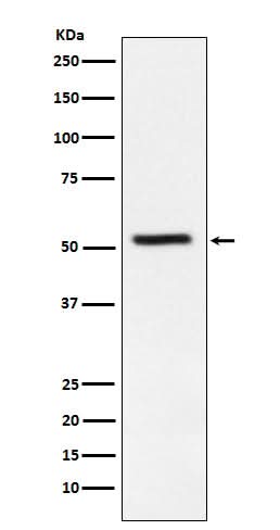 Anti-TrpRS Rabbit Monoclonal Antibody Boster Bio