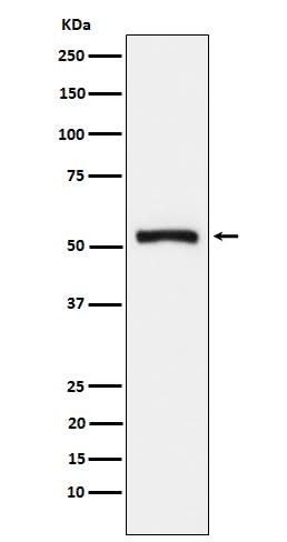 Anti-Tryptophanyl tRNA synthetase Rabbit Monoclonal Antibody Boster Bio