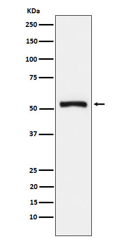 Anti-Tryptophanyl tRNA synthetase Rabbit Monoclonal Antibody Boster Bio