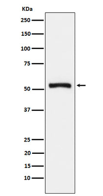 Anti-Tryptophanyl tRNA synthetase Rabbit Monoclonal Antibody Boster Bio
