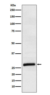 Anti-ApoM Rabbit Monoclonal Antibody Boster Bio
