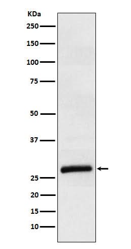 Anti-ApoM Rabbit Monoclonal Antibody Boster Bio