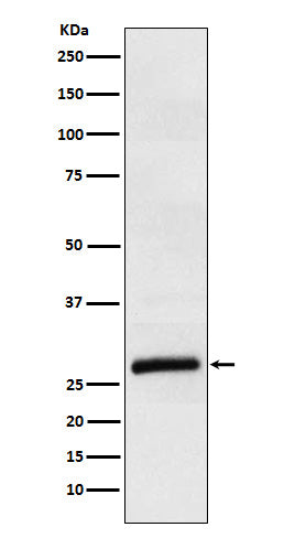 Anti-ApoM Rabbit Monoclonal Antibody Boster Bio