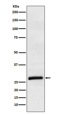 Anti-ApoM Rabbit Monoclonal Antibody Boster Bio