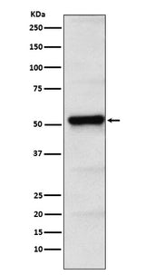 Anti-PICK1 Rabbit Monoclonal Antibody Boster Bio