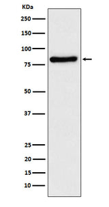 Anti-TLE1 Rabbit Monoclonal Antibody Boster Bio