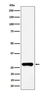 Anti-GSTO1 Rabbit Monoclonal Antibody Boster Bio