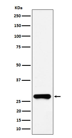 Anti-GSTO1 Rabbit Monoclonal Antibody Boster Bio