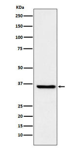Anti-GSTO1 Rabbit Monoclonal Antibody Boster Bio