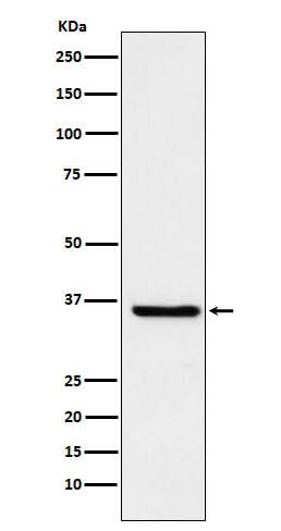 Anti-GSTO1 Rabbit Monoclonal Antibody Boster Bio