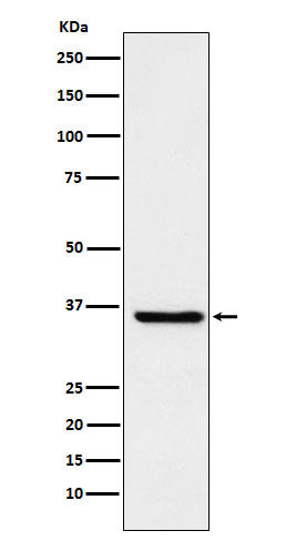 Anti-GSTO1 Rabbit Monoclonal Antibody Boster Bio