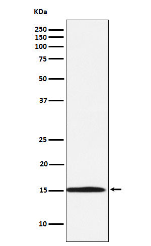Anti-Ube2N / Ubc13 Rabbit Monoclonal Antibody Boster Bio