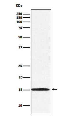 Anti-Ube2N / Ubc13 Rabbit Monoclonal Antibody Boster Bio