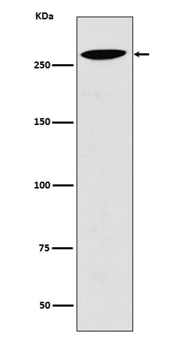 Anti-Lrp2 / Megalin Rabbit Monoclonal Antibody Boster Bio