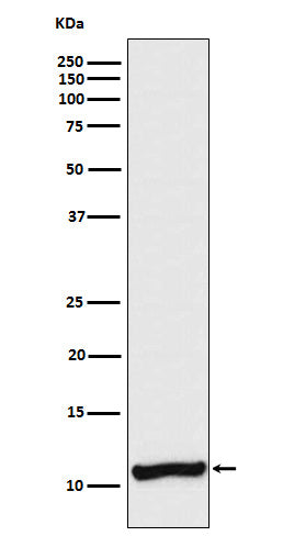 Anti-Cellubrevin Rabbit Monoclonal Antibody Boster Bio