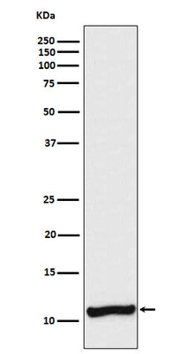 Anti-Cellubrevin Rabbit Monoclonal Antibody Boster Bio