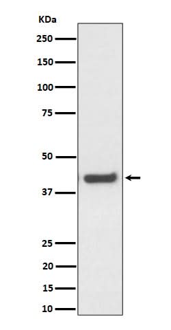 Anti-MVK Rabbit Monoclonal Antibody Boster Bio