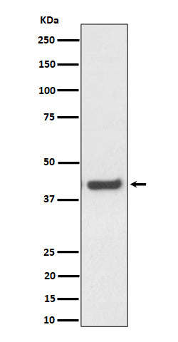 Anti-MVK Rabbit Monoclonal Antibody Boster Bio