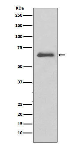 Anti-IRAK3/Irak M Rabbit Monoclonal Antibody Boster Bio