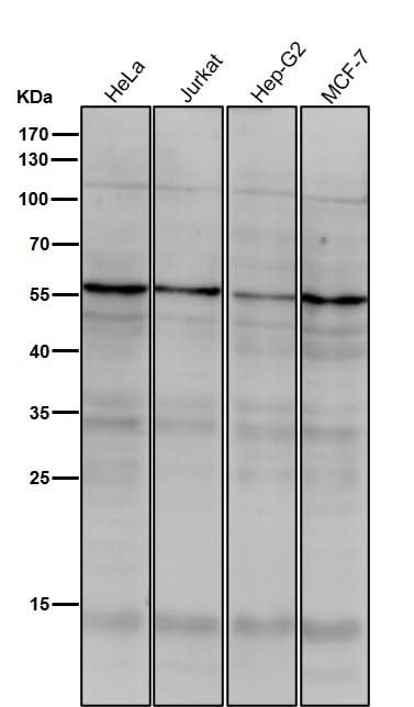 Anti-TRF1 TERF1 Rabbit Monoclonal Antibody Boster Bio