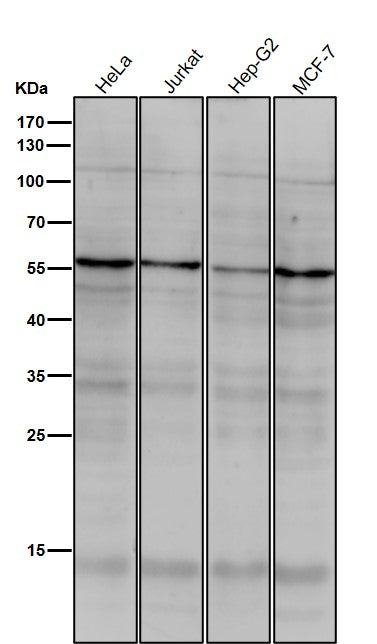 Anti-TRF1 TERF1 Rabbit Monoclonal Antibody Boster Bio