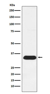 Anti-Syntenin Rabbit Monoclonal Antibody Boster Bio