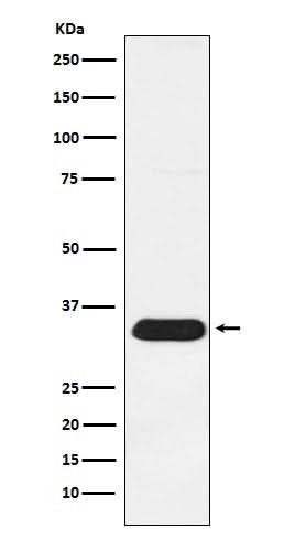 Anti-Syntenin Rabbit Monoclonal Antibody Boster Bio