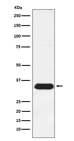Anti-Syntenin Rabbit Monoclonal Antibody Boster Bio