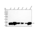 Anti-FABP1/L Fabp Rabbit Monoclonal Antibody Boster Bio