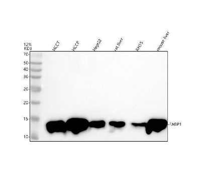Anti-FABP1/L Fabp Rabbit Monoclonal Antibody Boster Bio