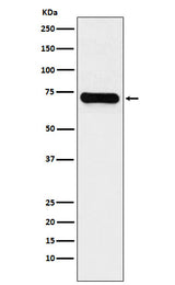 Anti-LysRS Rabbit Monoclonal Antibody Boster Bio