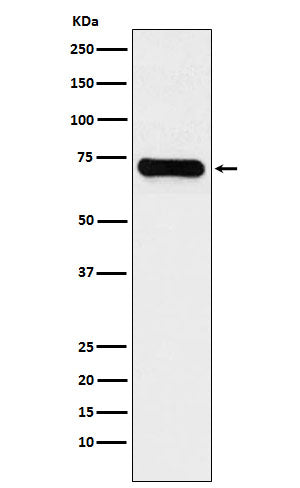 Anti-LysRS Rabbit Monoclonal Antibody Boster Bio