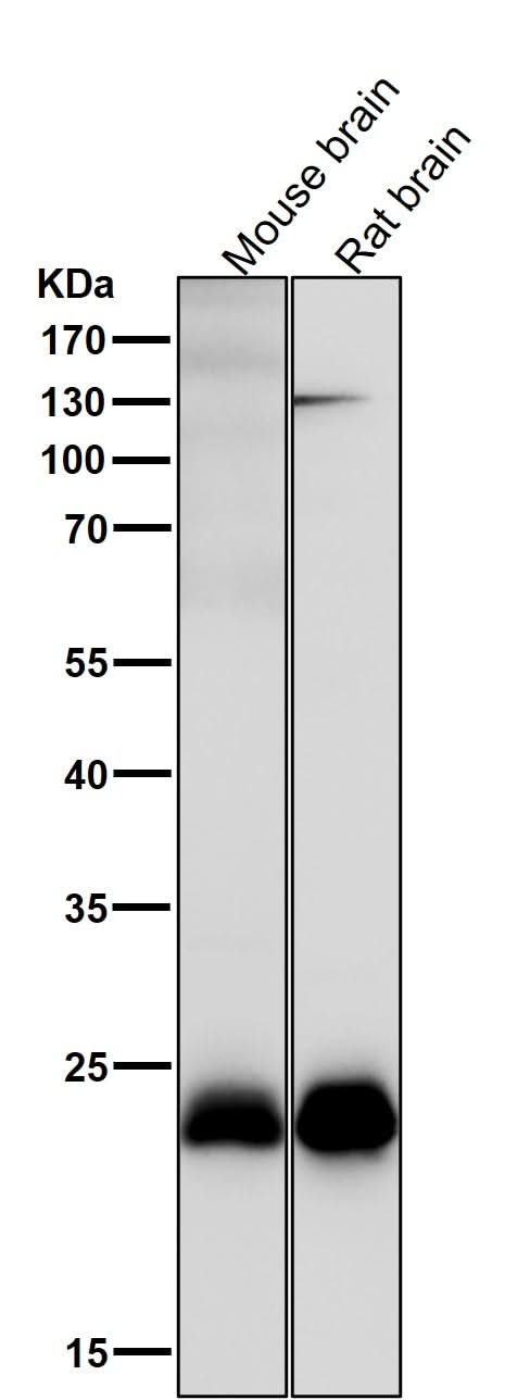 Anti-SNAP23 Rabbit Monoclonal Antibody Boster Bio